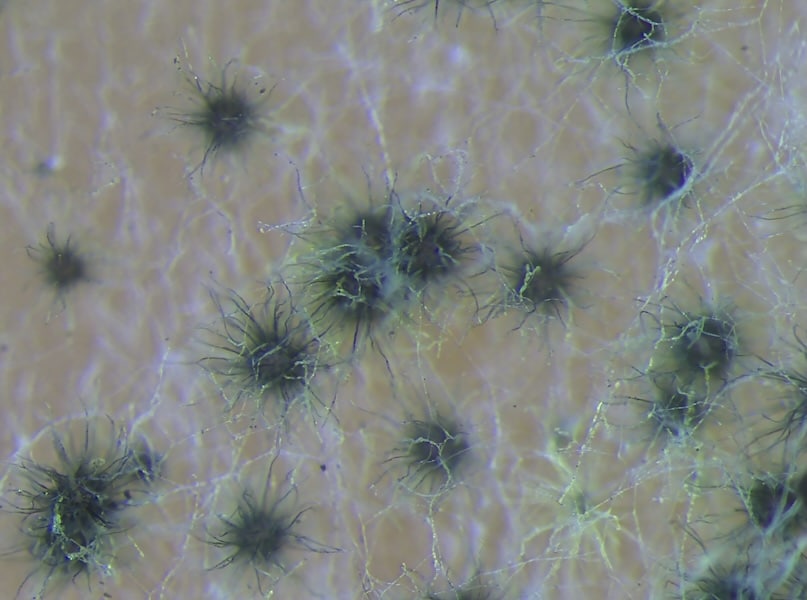 Moisture-related mold fungi